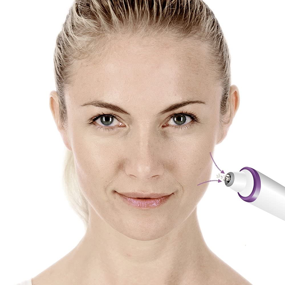 beurer-fc-76-microdermoabrasione-con-3-accessori-in-zaffiro-2-livelli-di-intensi image 4