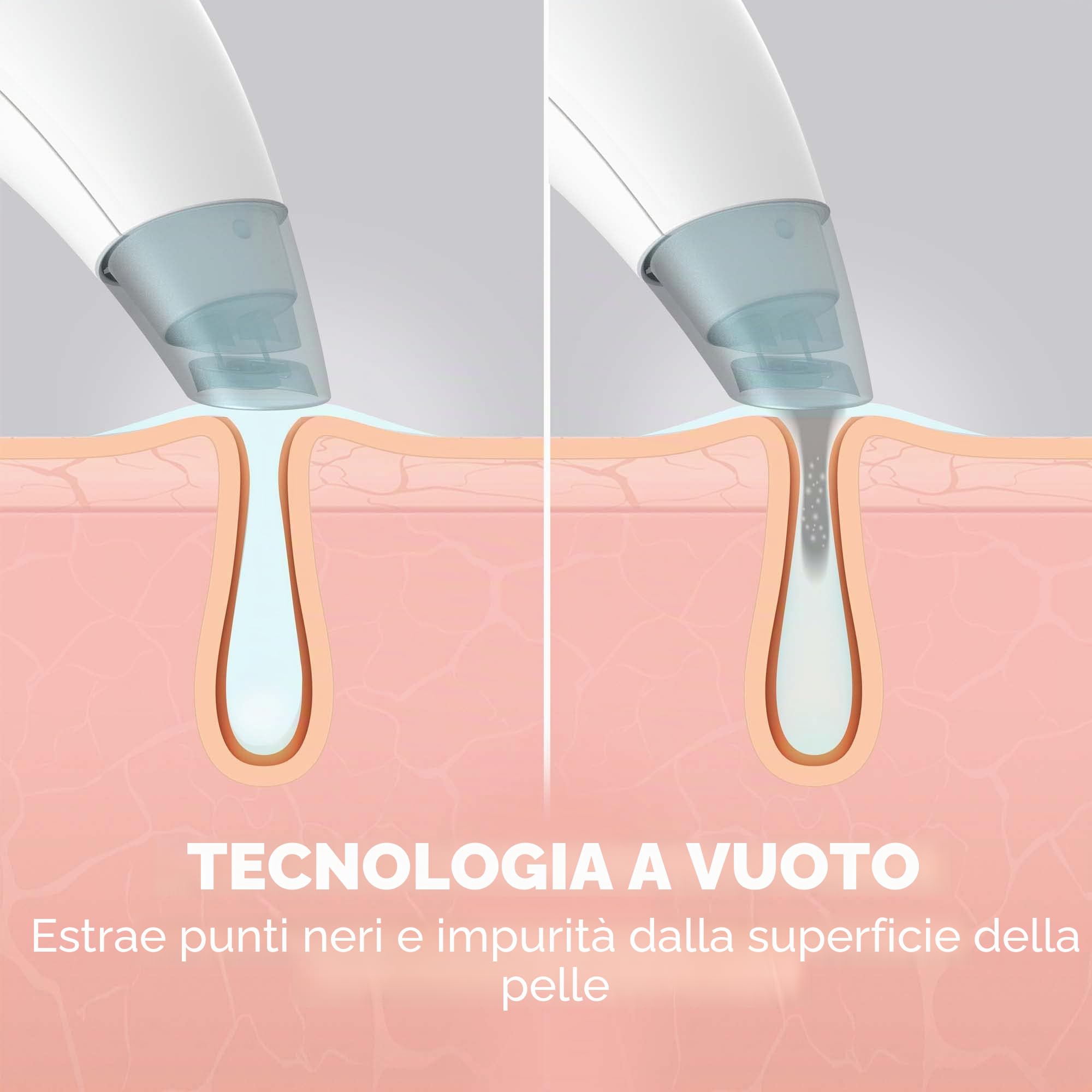 homedics-refresh-hydradermabrasion-cleanser-dispositivo-idrodermoabrasione-viso- image 4
